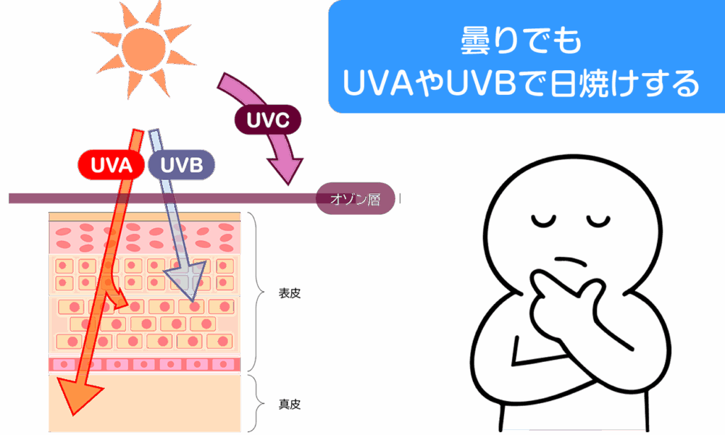 UV-Bは雲によってある程度遮断されますが、UV-Aはほとんど遮られません