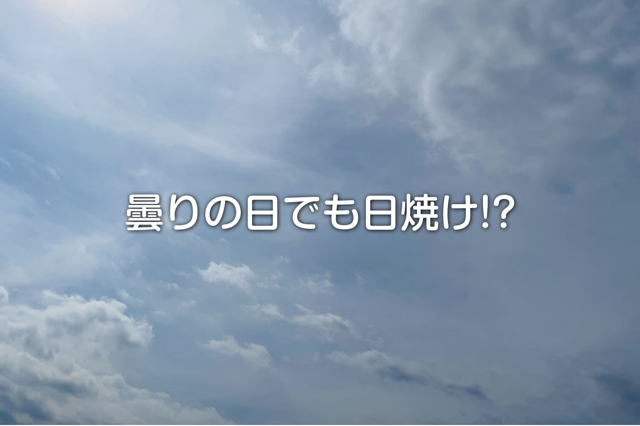 曇りの日でも日焼けする！？実は多い紫外線と正しいUV対策とはvol.060