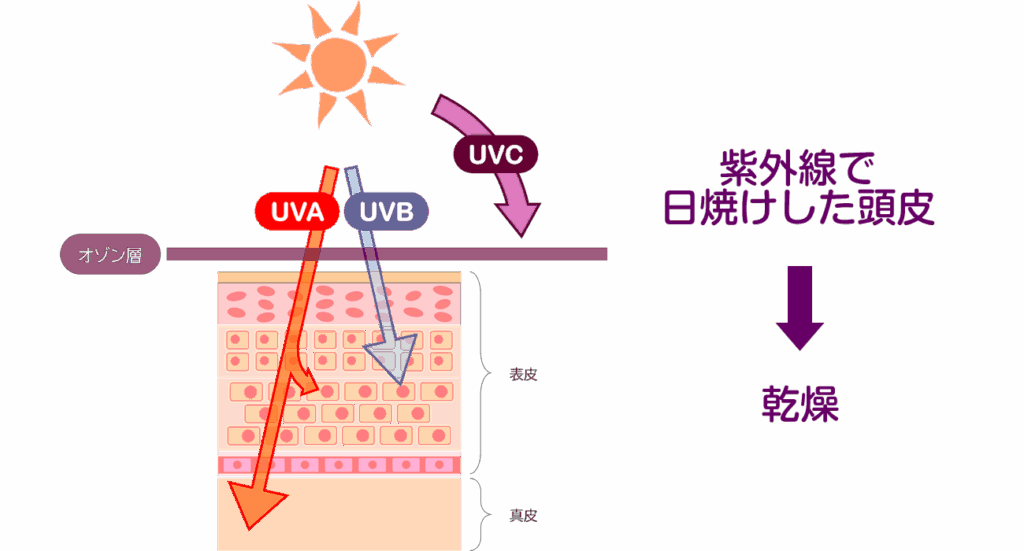 頭皮の日焼けによる深刻な影響とは